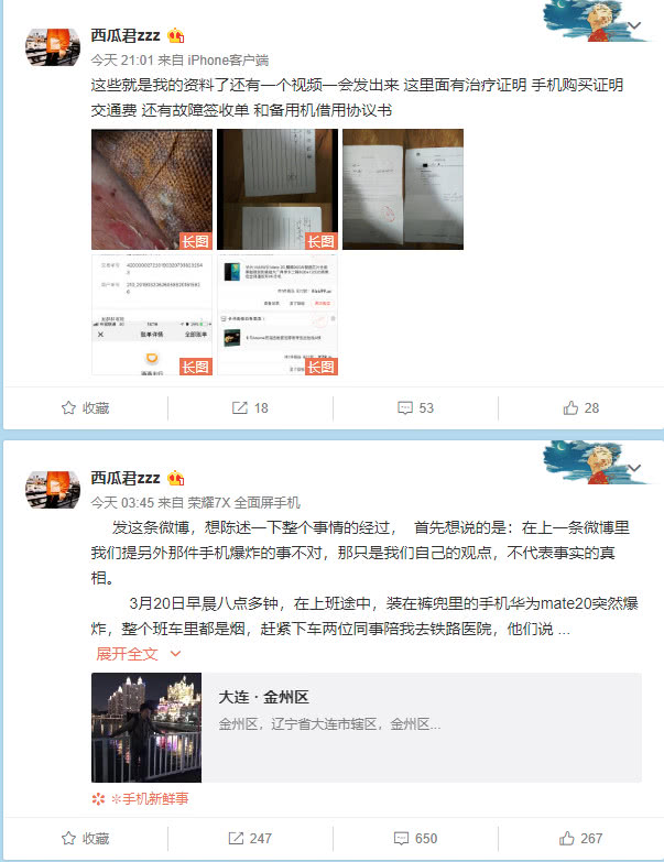 Mate 20電池意外起火致用戶大腿被燙傷:華為官方暫未回應 Mate 20電池意外起火致用戶大腿被燙傷:華為官方暫未回應